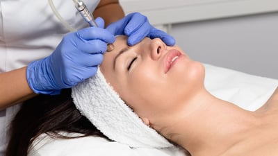 Moxi vs. Microneedling: Which Resurfacing is Right for You?
